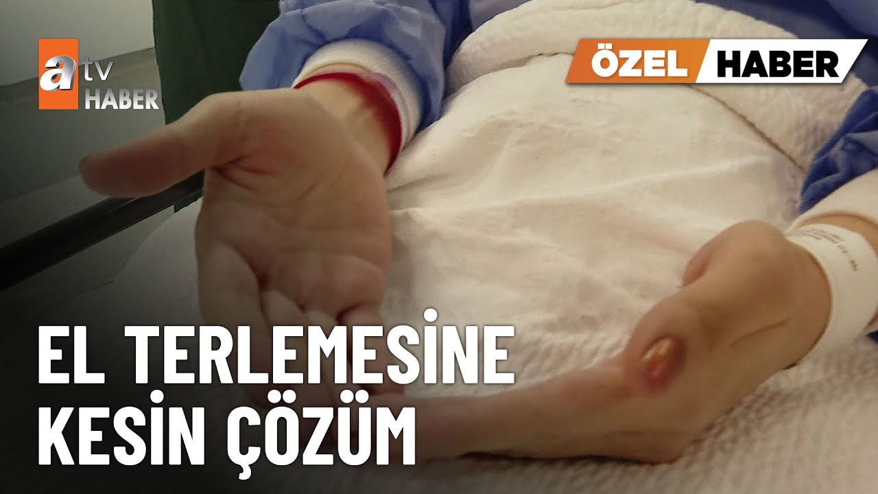 ÖZEL HABER - El terlemesine 40 dakikada son - atv Ana Haber 2 Şubat 2025