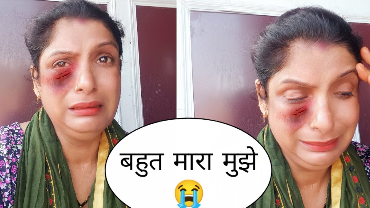 एक औरत की ऐसी हालत 😭@BabliUttarakhandivlog