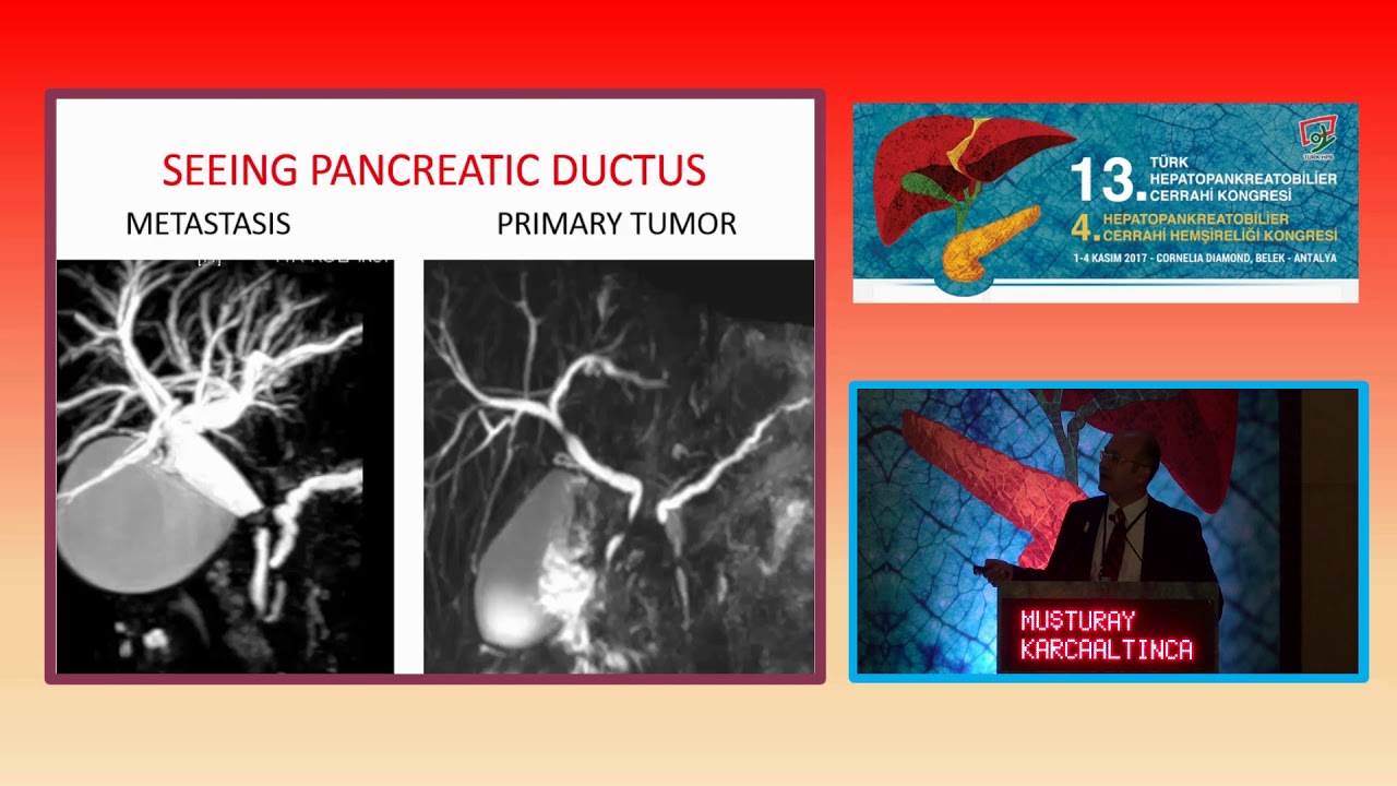 Muşturay Karçaaltıncaba / Developments in biliary imaging