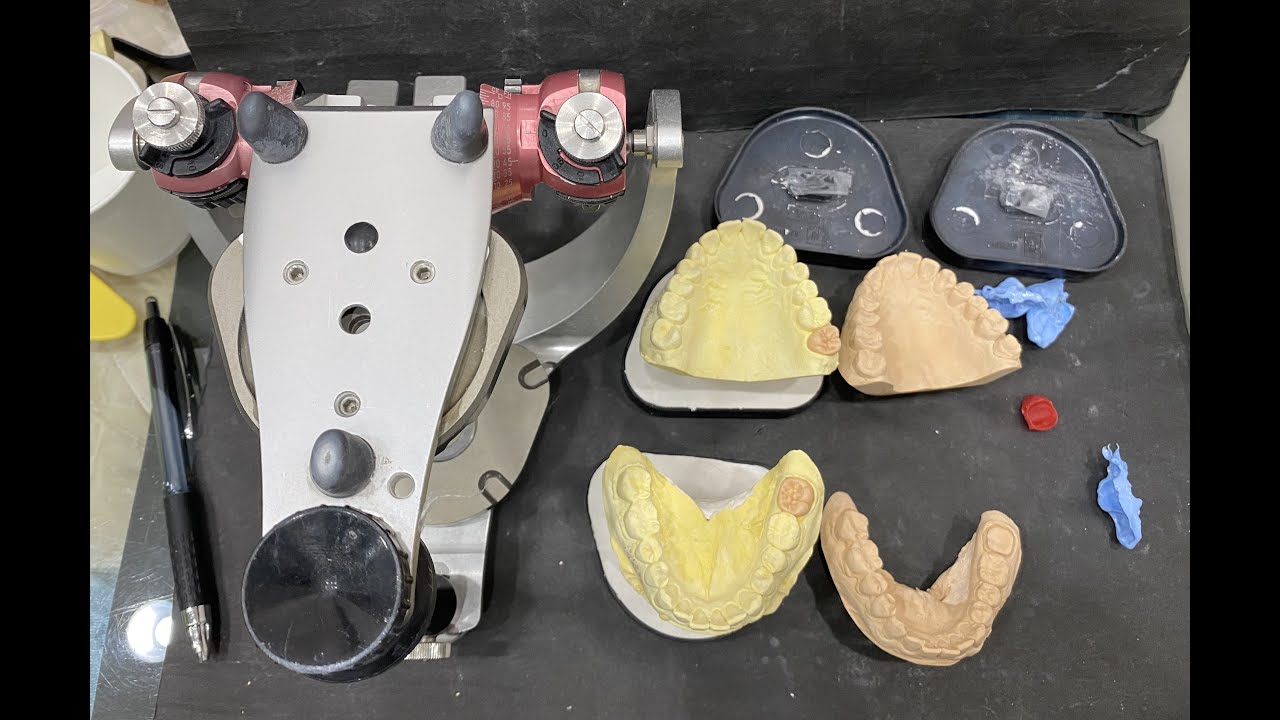 cross mounting - lower working cast, first