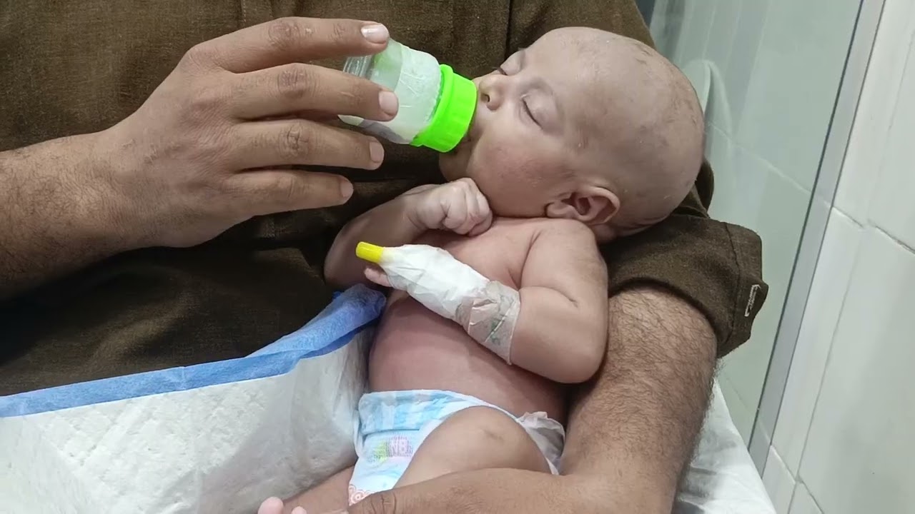 Bronchiolitis Baby Feeding | Safe Feeding During Breathing Difficulty