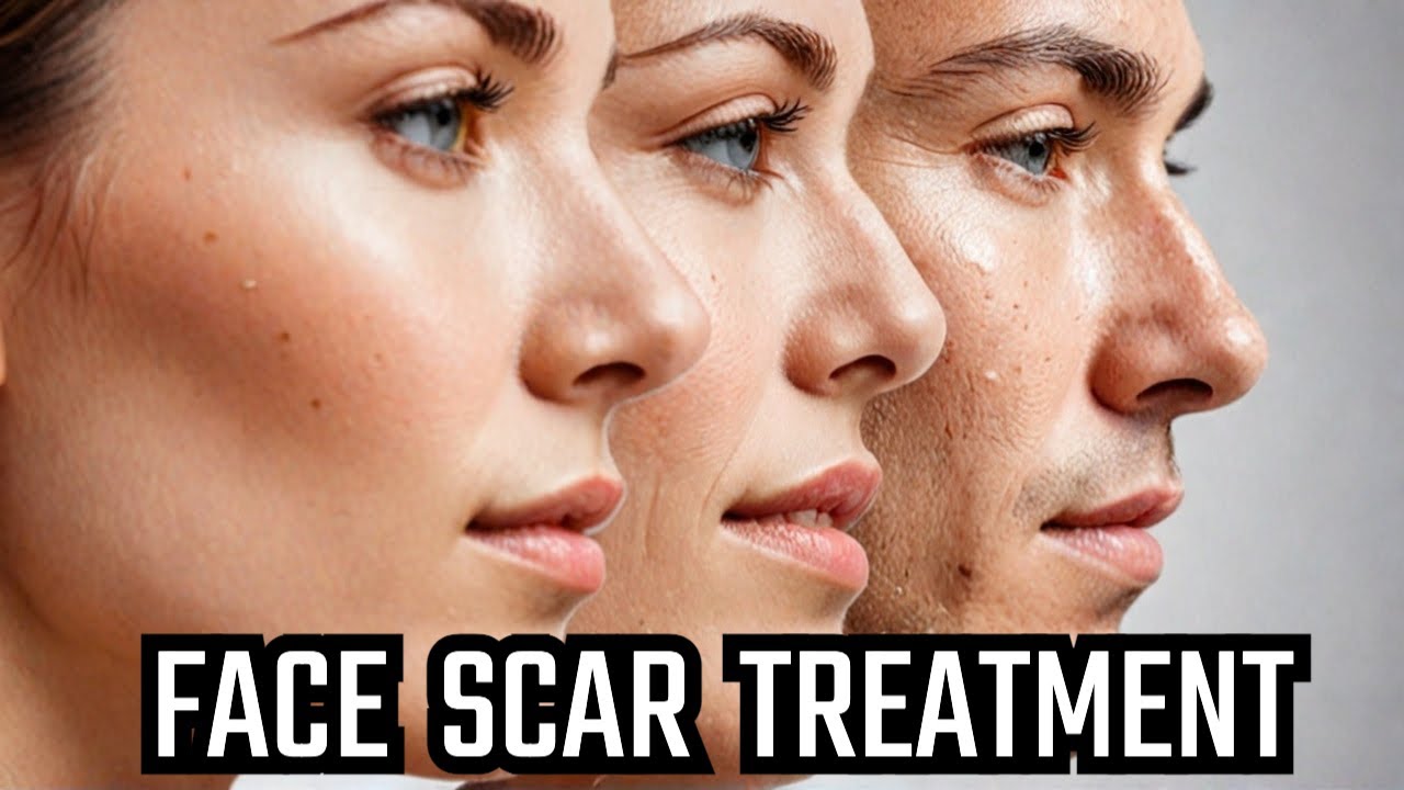 Face Scar Treatment: Full Ablative vs Fractional CO2 Laser | Nose Reshaping Combo