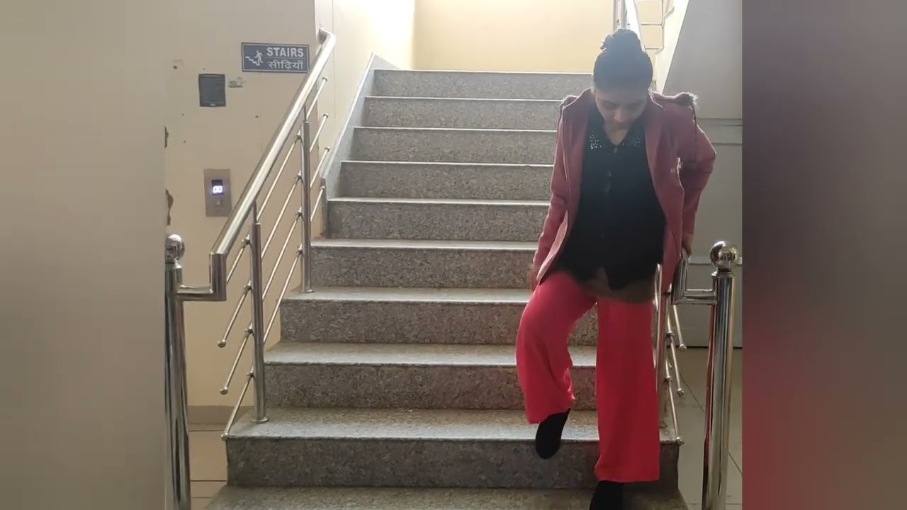 मुडी हुयी टांगे -ऐक दम सीधी। Bent knees Abnormal walk - excellent results after surgery. 