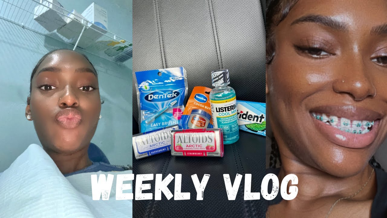 Vlog| Come With Me To Get Braces!