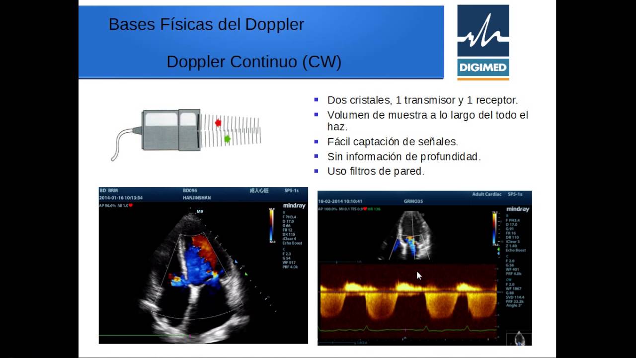 Bases Físicas del Ultrasonido Parte 3 (Física del Doppler)