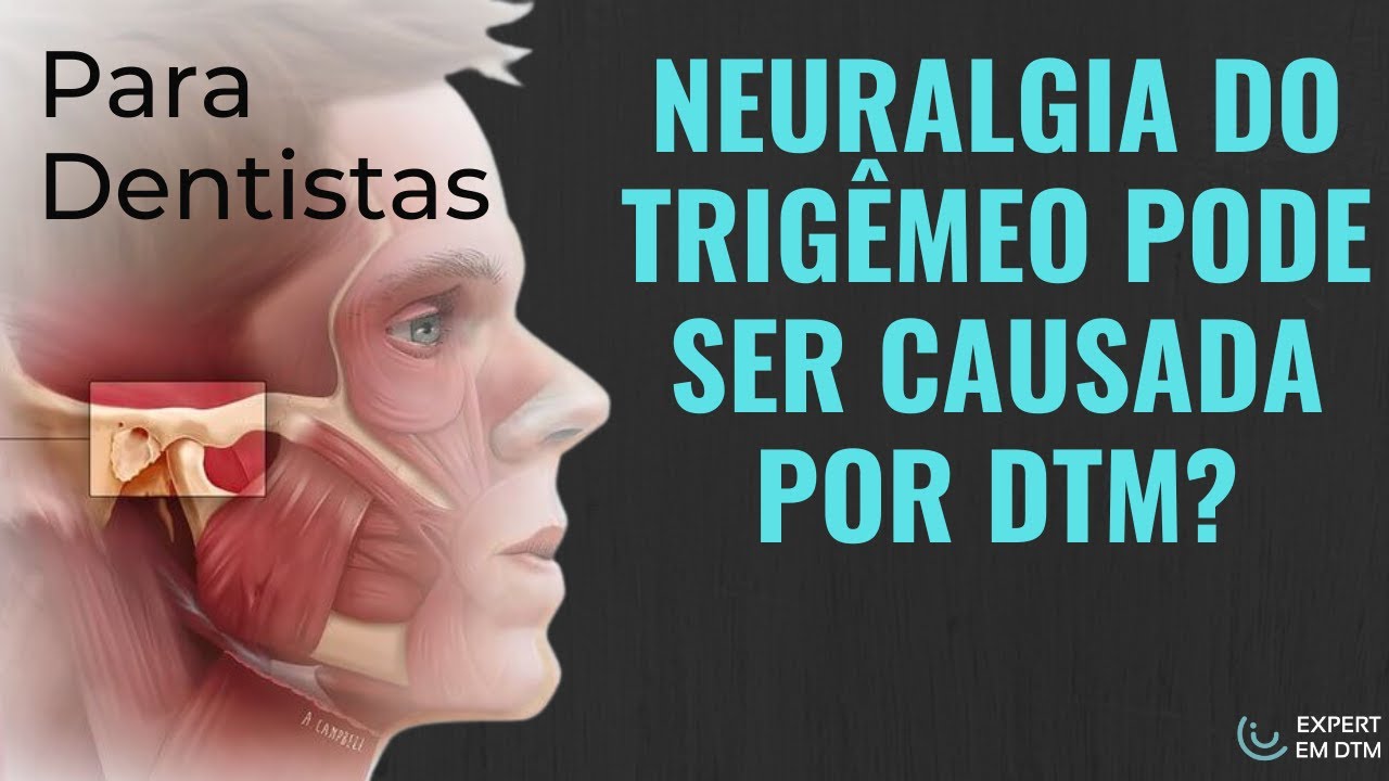 [DENTISTA] Neuralgia do trigêmeo pode ser causada por DTM?