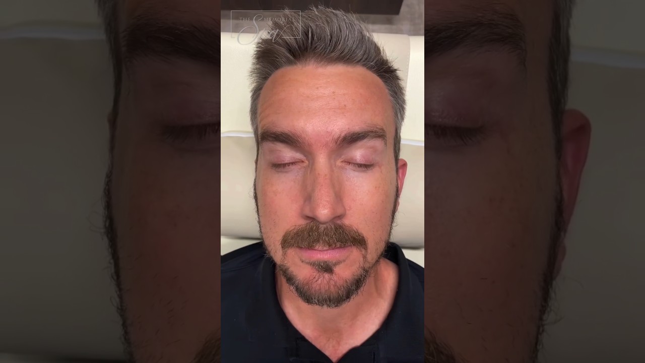 Botox & Dysport Houston | Before and After