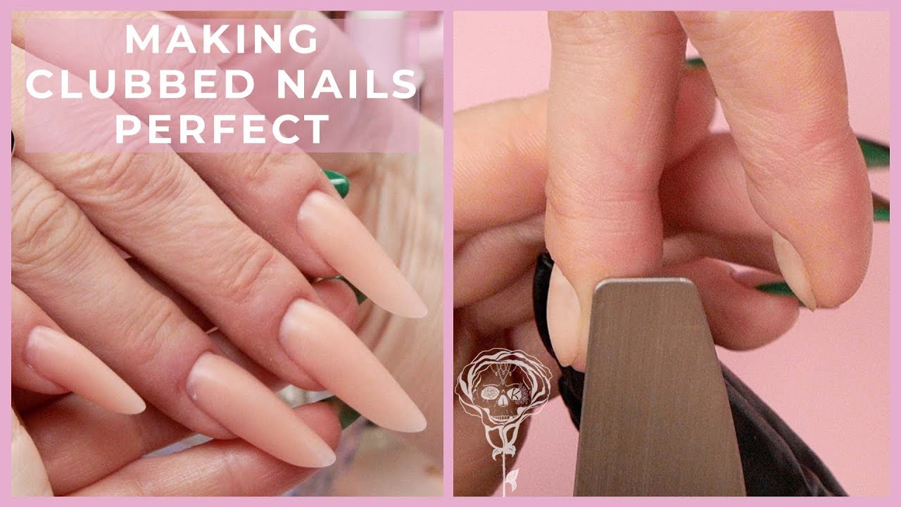 Ugly to Pretty Nails | Fixing Slightly Clubbed Nails