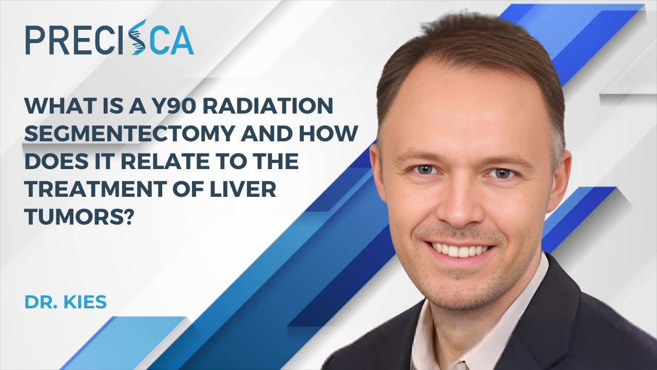 What is a Y90 radiation segmentectomy and how does it relate to the treatment of liver tumors?