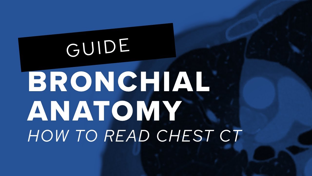 How to read chest CT: bronchial anatomy