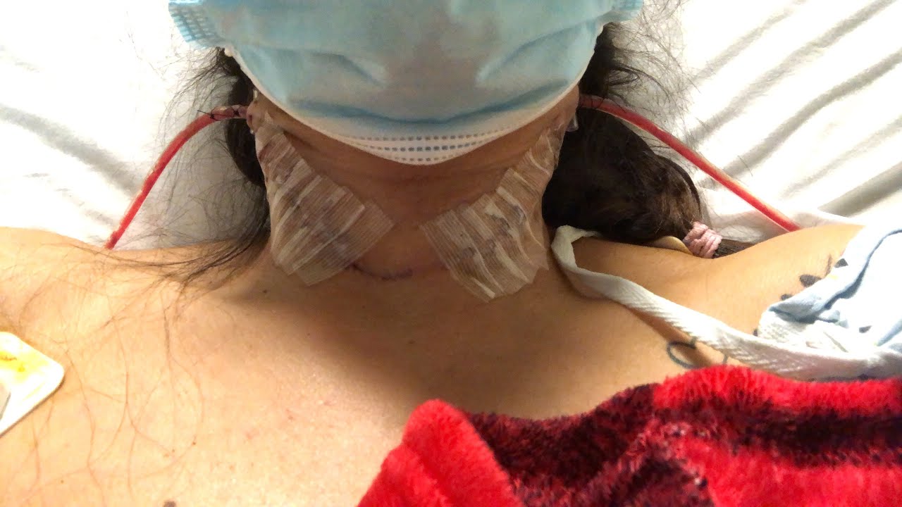 EL DÍA DE MI CIRUGÍA/ CANCER DE TIROIDES🎗