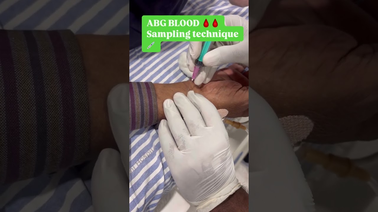 ABG Sampling Techniques - A Nurse's Guide