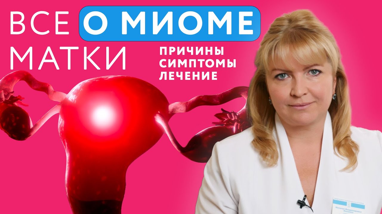 Миома матки лечение || Миома матки симптомы || Миома матки причины #миома #миомаматки #онклиник