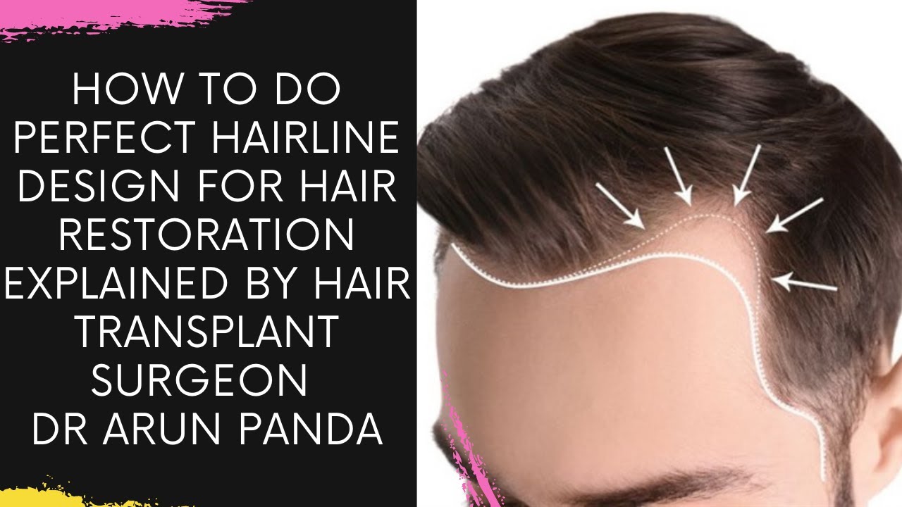 How to do perfect hairline design for hair restoration explained by Hair Transplant Surgeon Dr Arun