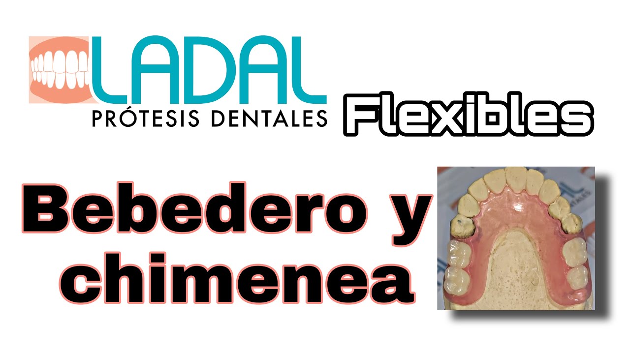 Cómo hacer bebederos y chimenea para Partial Flex