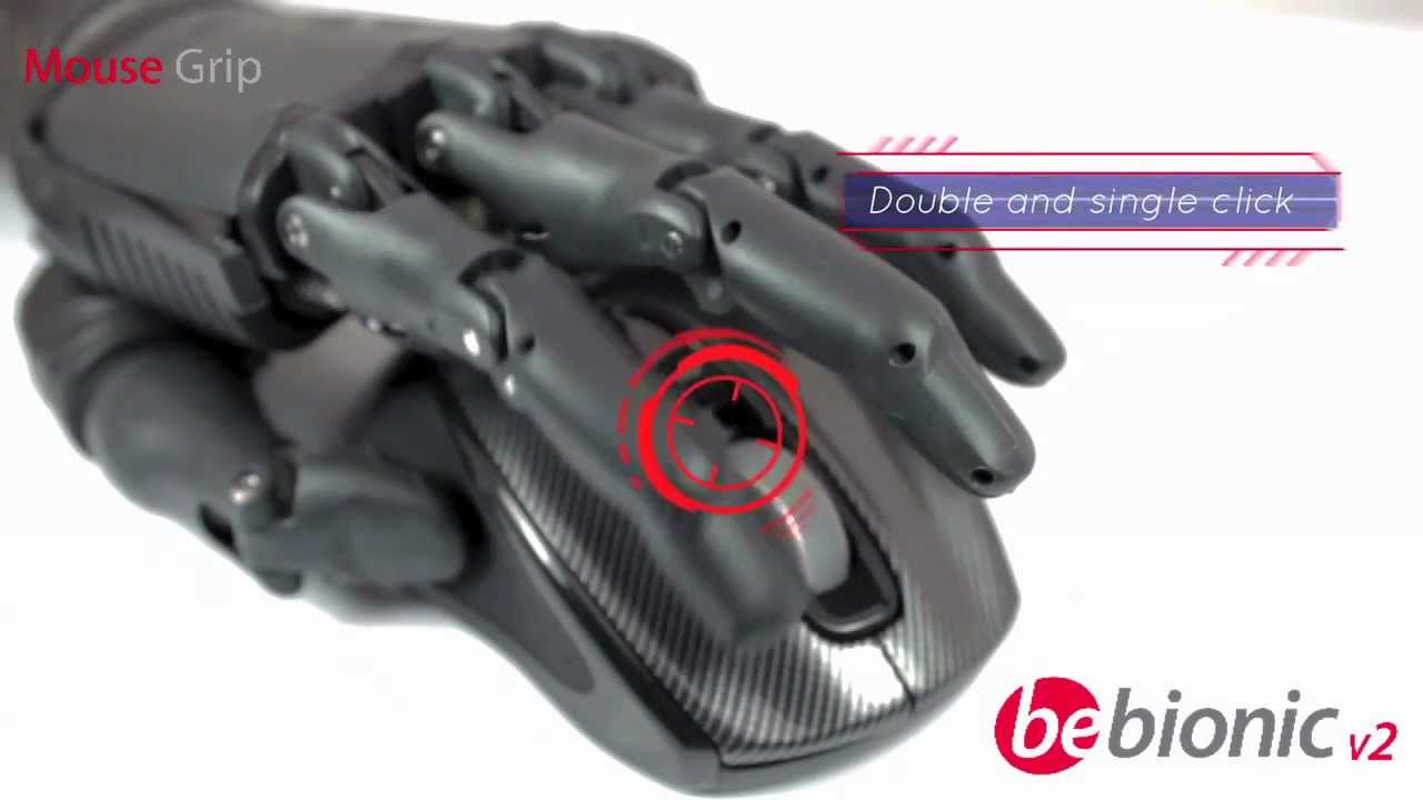 Mano bebionic. Prótesis biónica (Ideo Ortopedias - SEVILLA)