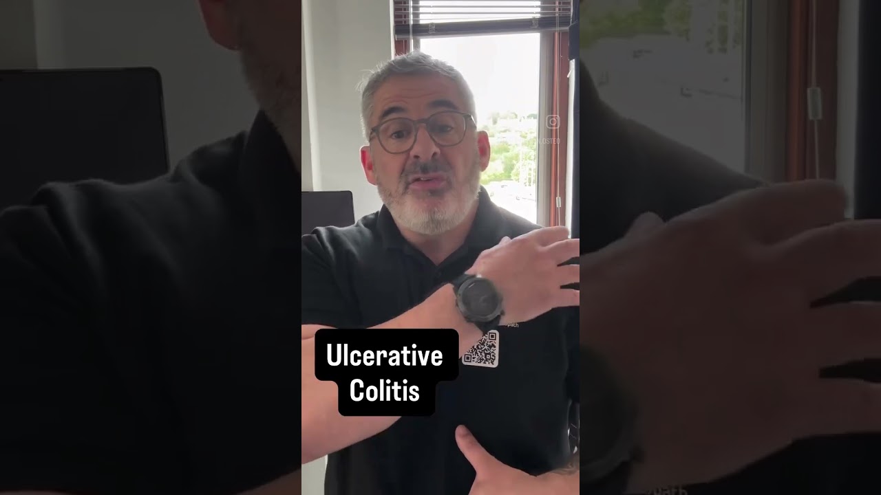 Ulcerative colitis and joint pains