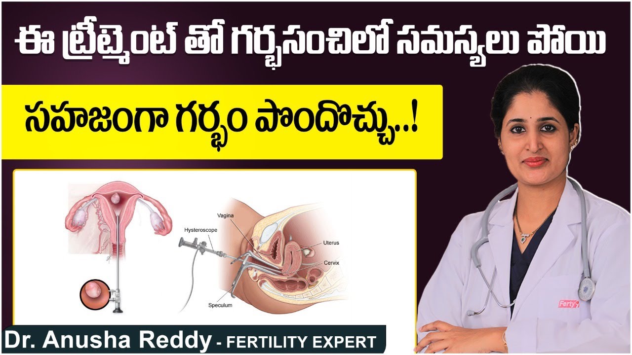 హిస్టెరోస్కోపీ ఎవరికీ చేస్తారు | Advantages of Hysteroscopy Treatment Telugu | Best Fertility Center