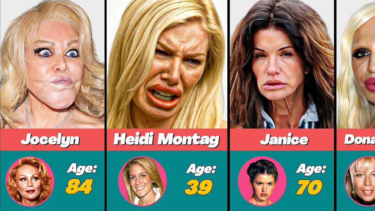 😱 The Most SHOCKING Celebrity Plastic Surgery Disasters Ever