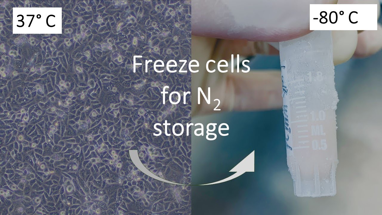 Freezing cells with DMSO and FBS
