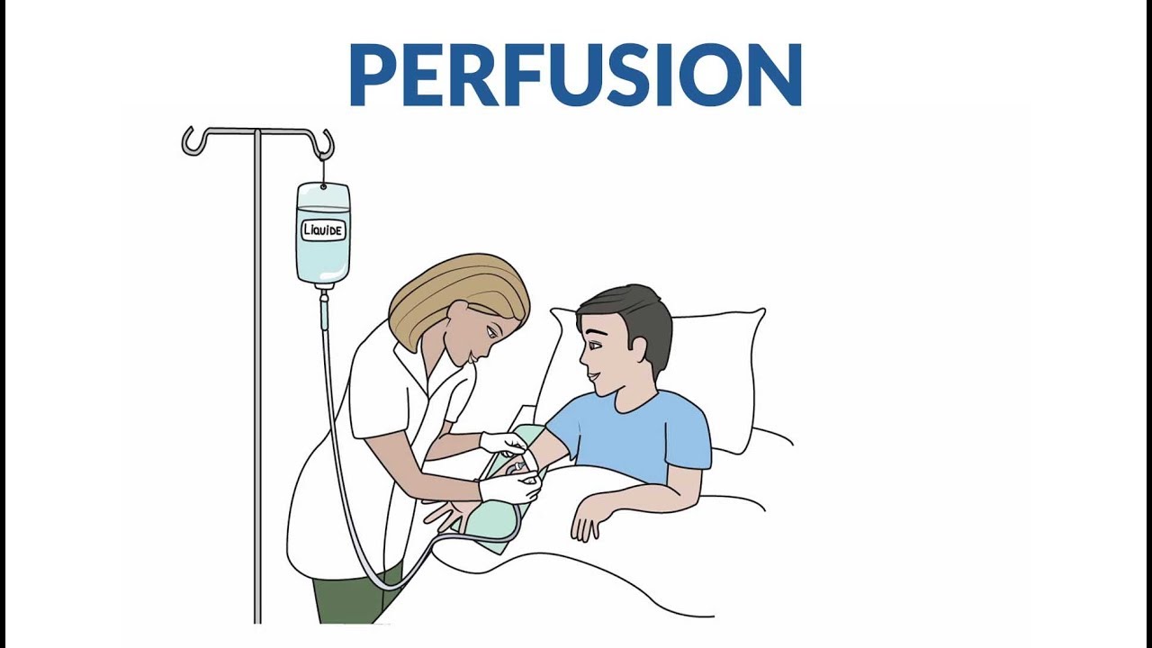 Comment se passe une perfusion ?