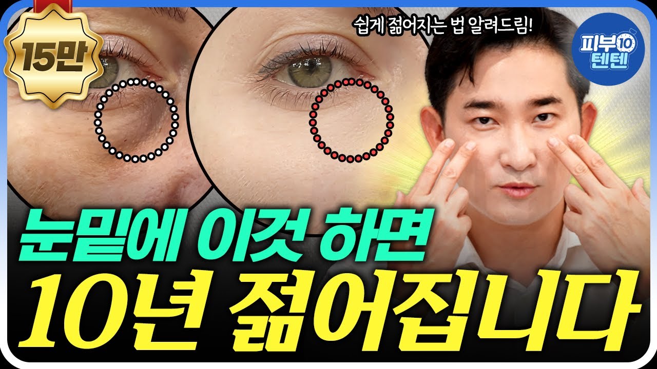 Как убрать отёки под глазами всего за 10 минут | Узнайте, почему отёки под глазами и как это испр...