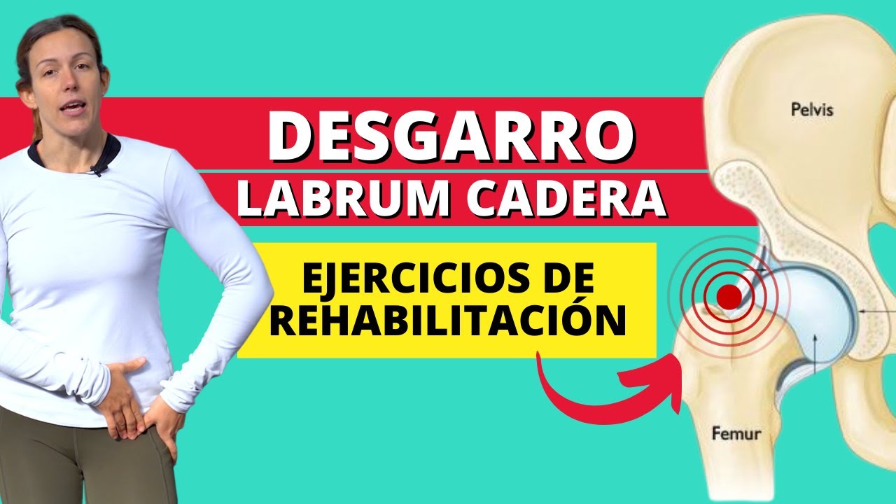 Ejercicios para Lesión o Desgarro del Labrum de Cadera - Qué es, Síntomas y Tratamiento