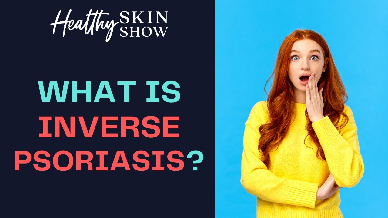 What is INVERSE PSORIASIS?! | Jennifer Fugo