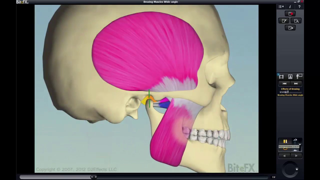 Amplifying The Three Golden Rules of Occlusion