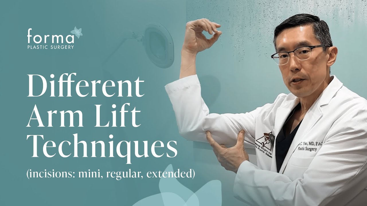 Different Arm Lift Incisions (Mini, Regular, Extended) |Dr. David C. Yao from Forma Plastic Surgery