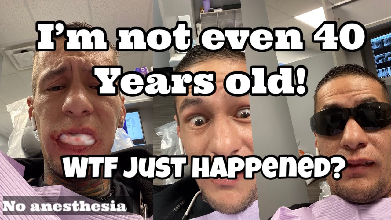 FULL MOUTH EXTRACTION / IMMEDIATE DENTURES