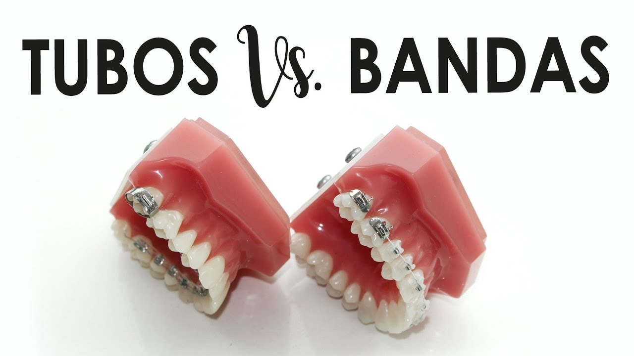 BANDAS Vs. TUBOS | ¿QUÉ SON? ¿CUÁL ES MEJOR?