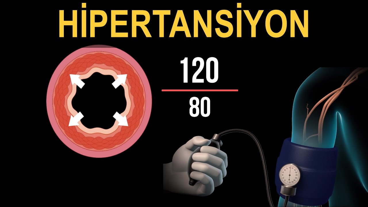 Hipertansiyon