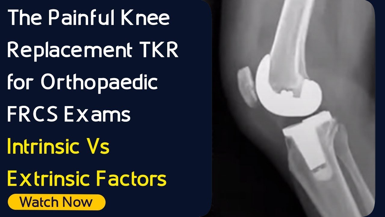 The Painful Knee Replacement TKR for Orthopaedic FRCS Exams | Intrinsic Vs Extrinsic Factors