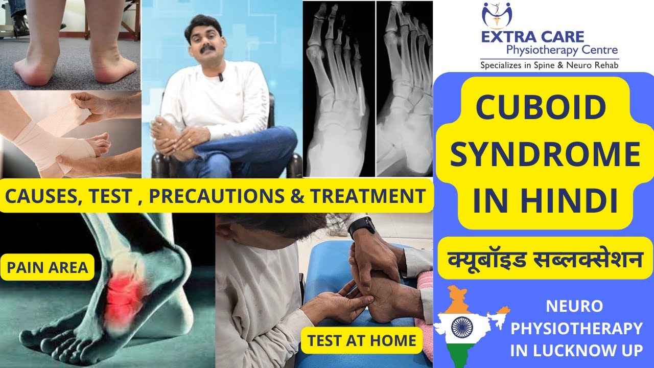 Cuboid Syndrome in Hindi | Lateral Foot pain, Causes, Signs and diagnosis and Treatment | Extra Care