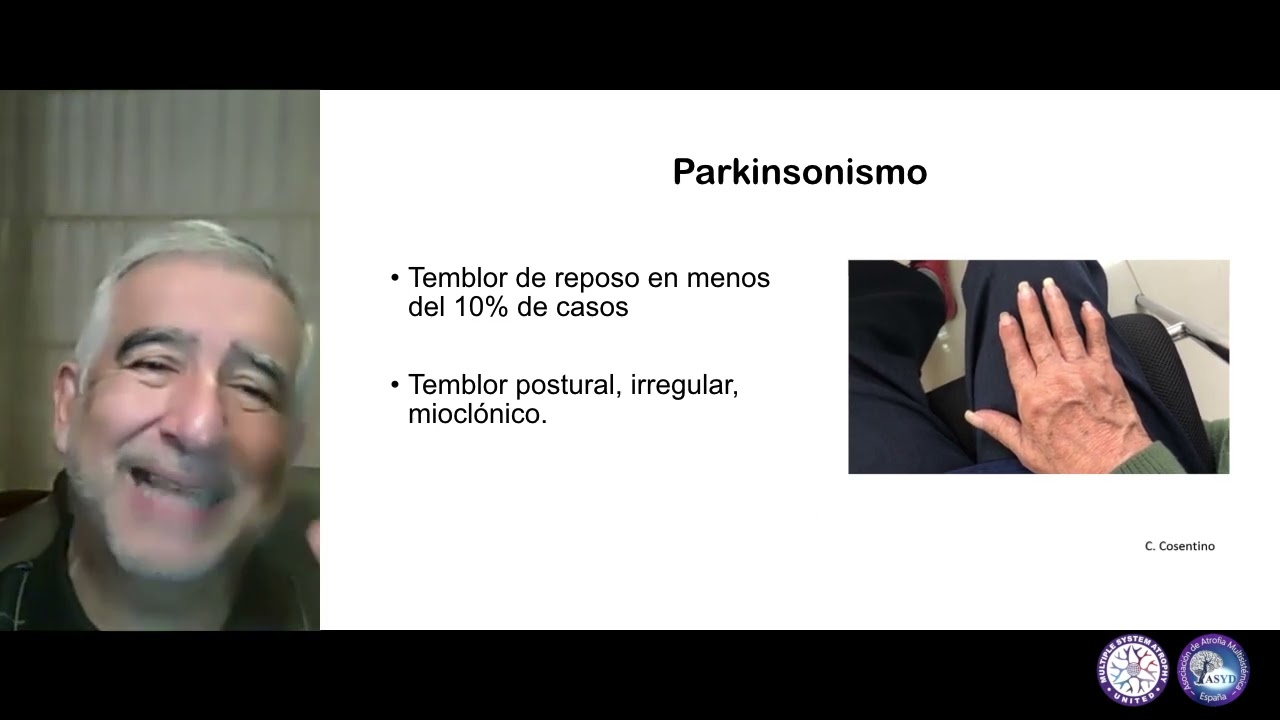 Sintomas Motores an Atrofia Multisistémica - Carlos Cosentino, MD, FAAN