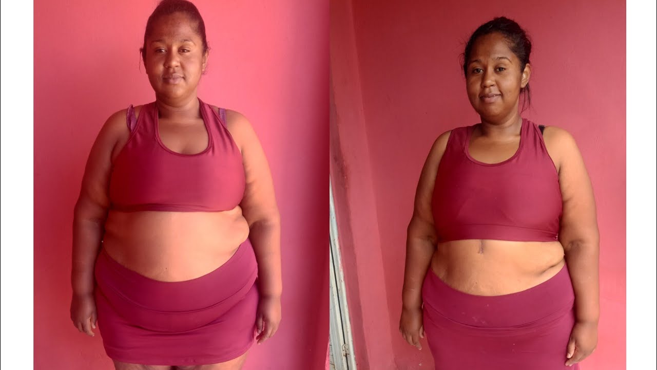 O PORQUE DO MEU SUMIÇO// NÃO VOU MAIS GRAVAR VÍDEO NO YOUTUBE 🤔// FIZ CIRURGIA 🫣