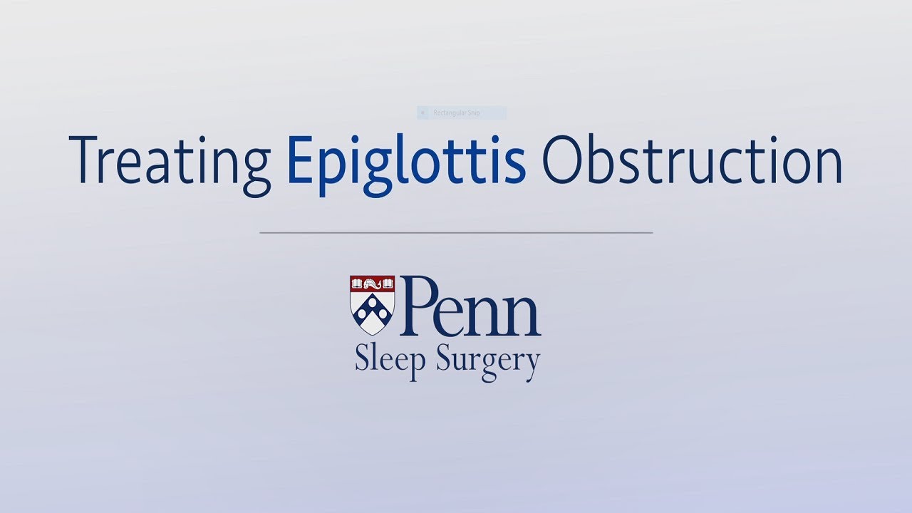 Treating Epiglottis Obstruction | Penn Sleep Surgery
