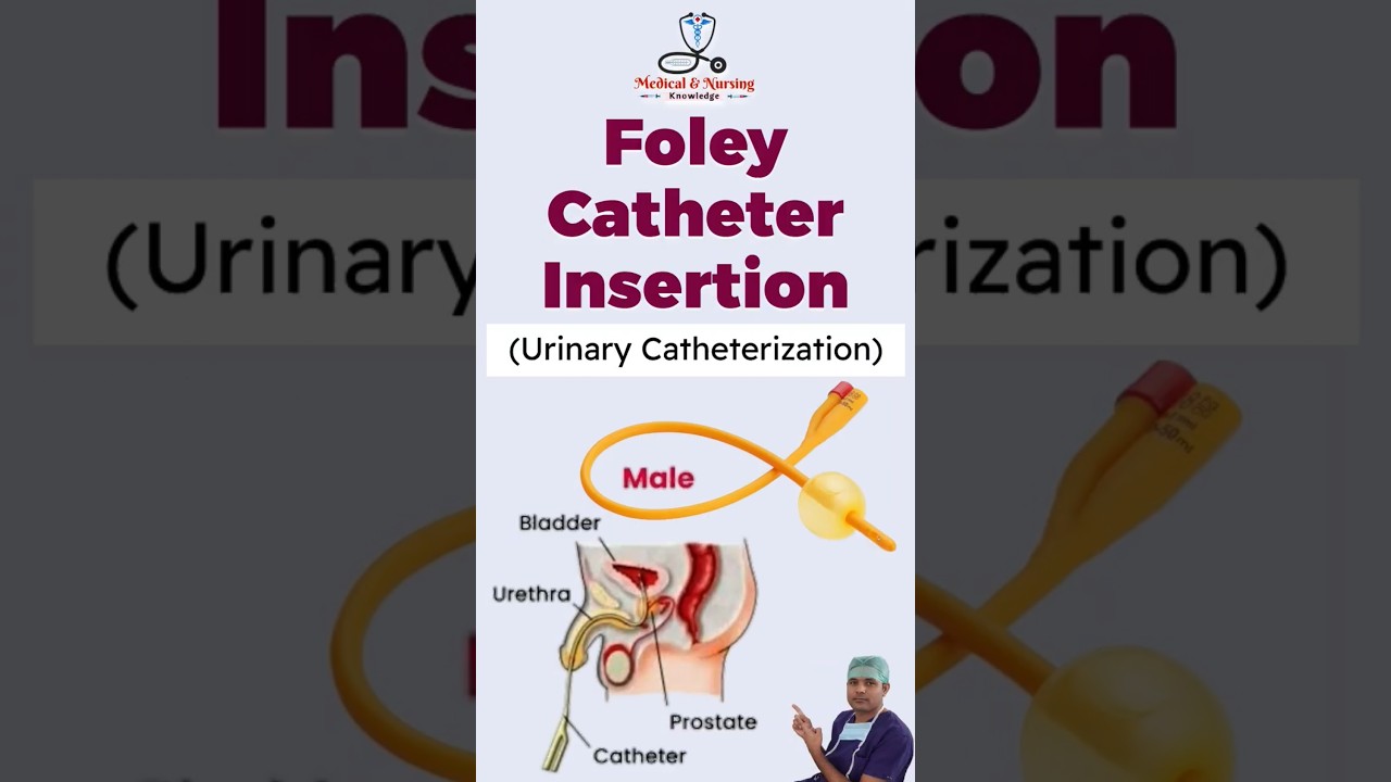 Foley Catheter || Inserting Urinary Catheter || Urinary Catheterization || #hospital #nursing #nurse