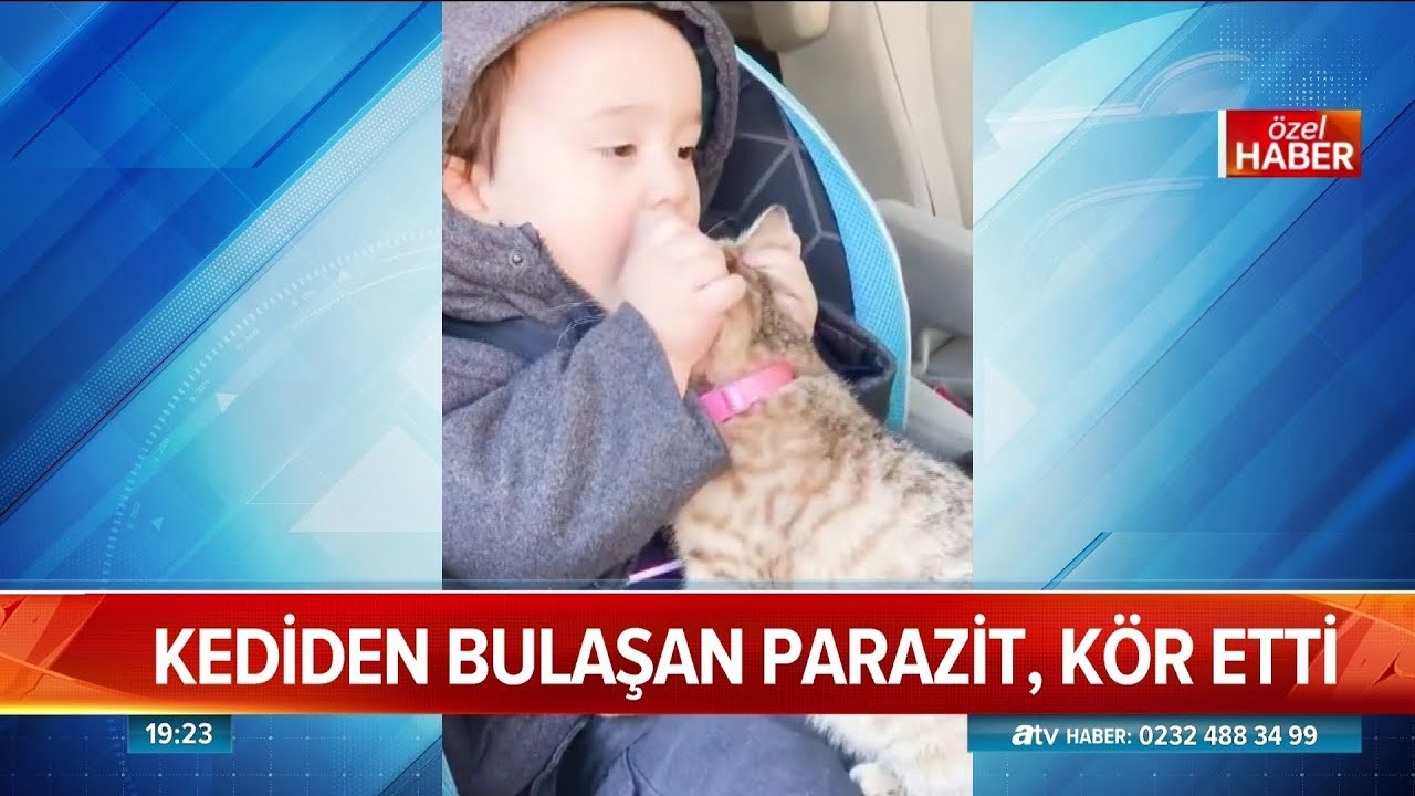 Kediden bulaşan parazit, k&ouml;r etti - Atv Haber 22 Ocak 2019
