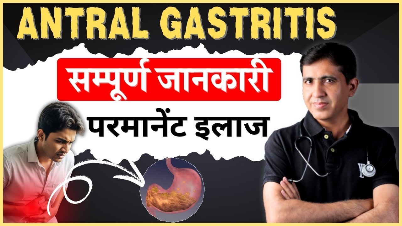 Antral Gastritis का इलाज | Antral Gastritis क्या है? कारण, लक्षण और उपचार हिंदी में
