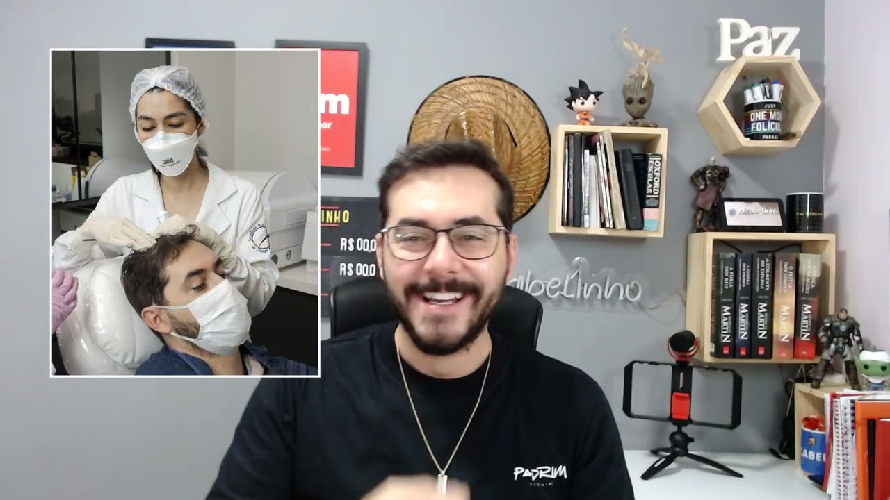 TRANSPLANTE CAPILAR EVOLUÇÃO 10 MESES  (SORTEIO DE TRANSPLANTE CAPILAR)