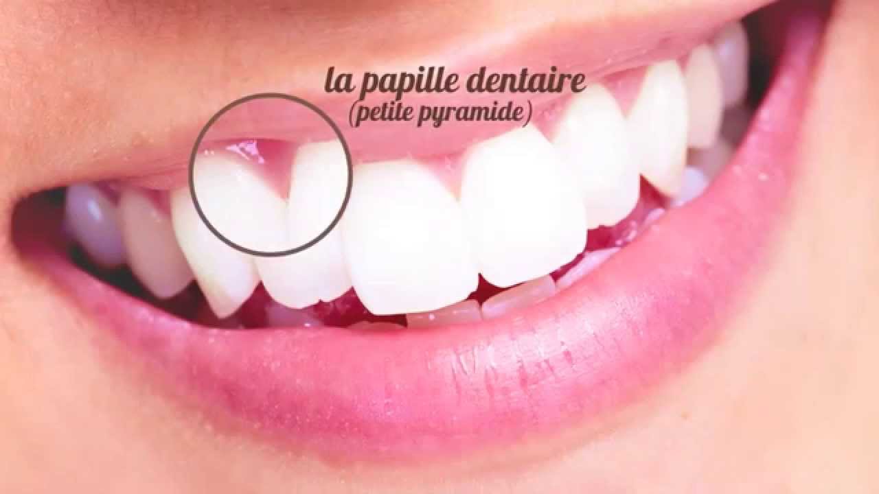 Comment prendre soin de vos dents?