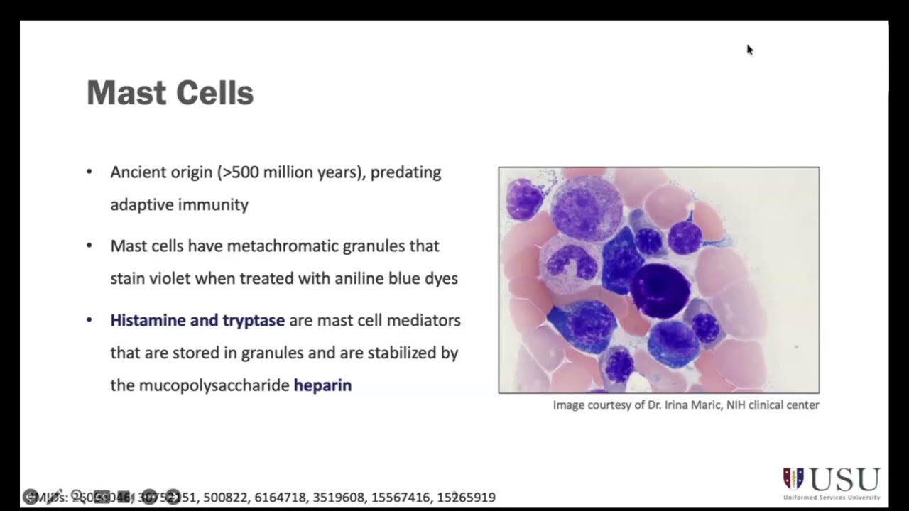 Systemic Mastocytosis - Screening and Diagnosis (Boggs)