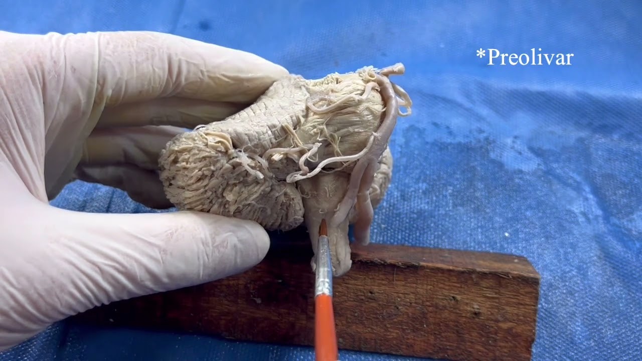 Mostración Cadavérica 2022 - Tronco del encéfalo
