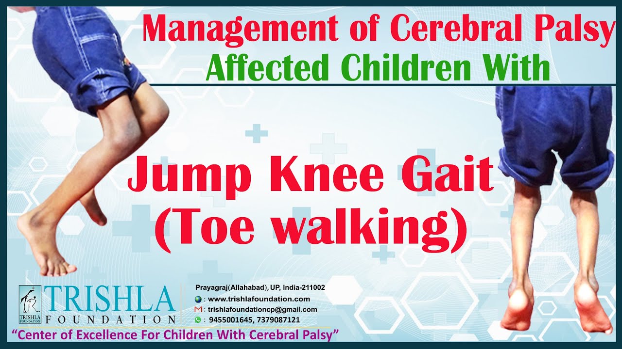 Management of Cerebral Palsy Affected Children With Jump Knee Gait (Toe walking) |Trishla Foundation