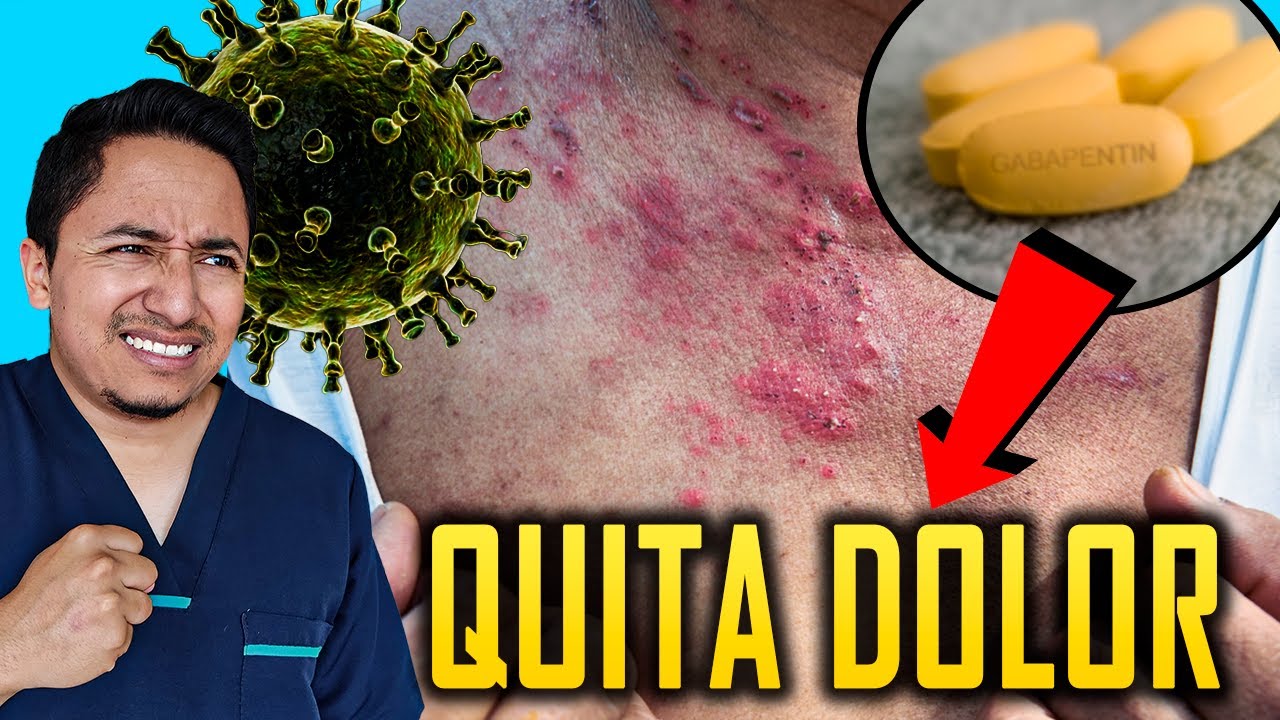 Calma el DOLOR del Herpes Zoster y No sufras más la Neuralgia Post herpética