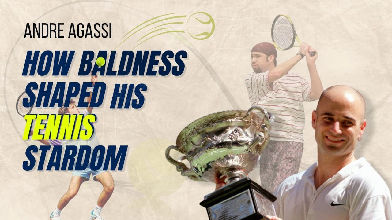 Andre Agassi, How baldness shaped his Tennis Stardom