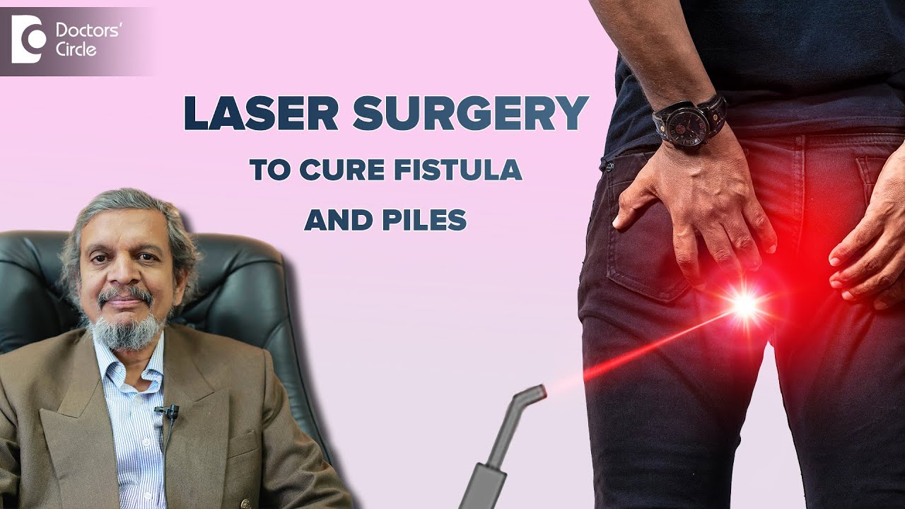 Recurrence after Laser Surgery for Piles, Fissures & Fistulas - Dr. Rajasekhar M R| Doctors' Circle