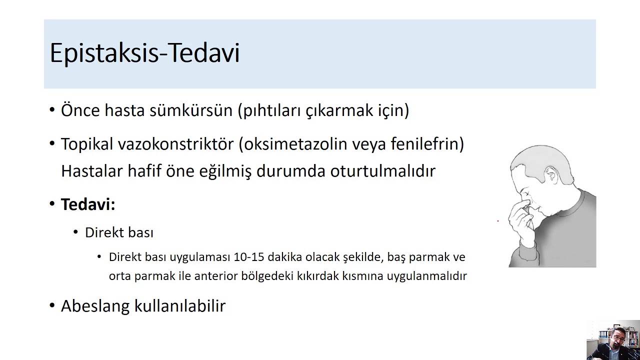 AS'de Epistaksis